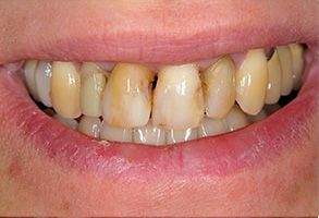 Michael Korngold, DDS | Pediatric Dentistry, Veneers and Teeth Whitening