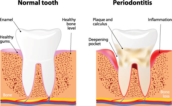 Michael Korngold, DDS | Dentures, Root Canals and Preventive Program